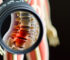 alt_text: Anatomical illustration of lumbar disc health, highlighting symptoms and inviting patient education.