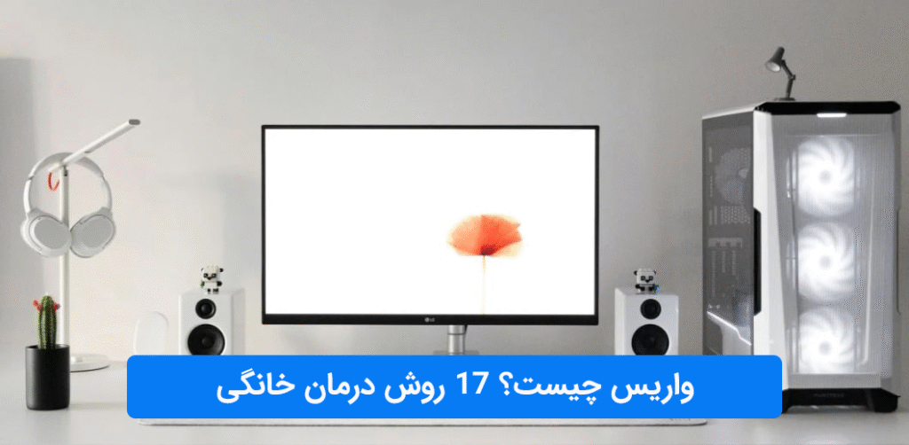 واریس چیست؟ 17 روش درمان خانگی