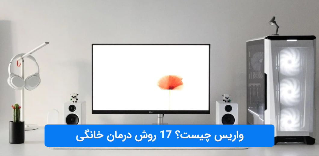 واریس چیست؟ 17 روش درمان خانگی